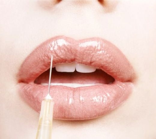 The Basic Principles Of Natural Looking Lip Filler Injections - Santa Monica  thumbnail