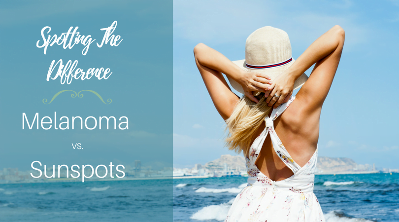 Spotting the Difference: How to Identify a Sunspot from Melanoma