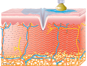 collagen_synthesis_begins-copy-1