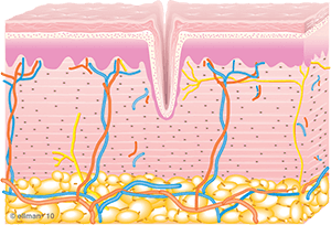 untreated_skin-copy_1-1
